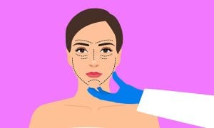 The rise of plastic surgery